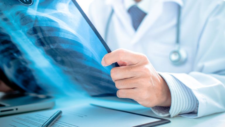 Simple Blog Post Title (Demo)