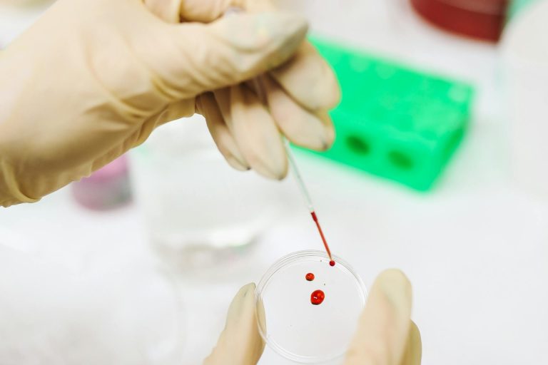 Alzheimer's blood test plasma p-tau217 early diagnosis laboratory | Healthcare Discovery