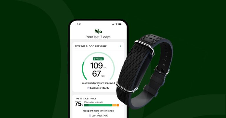 Aktiia bracelet cuffless blood pressure monitor official image