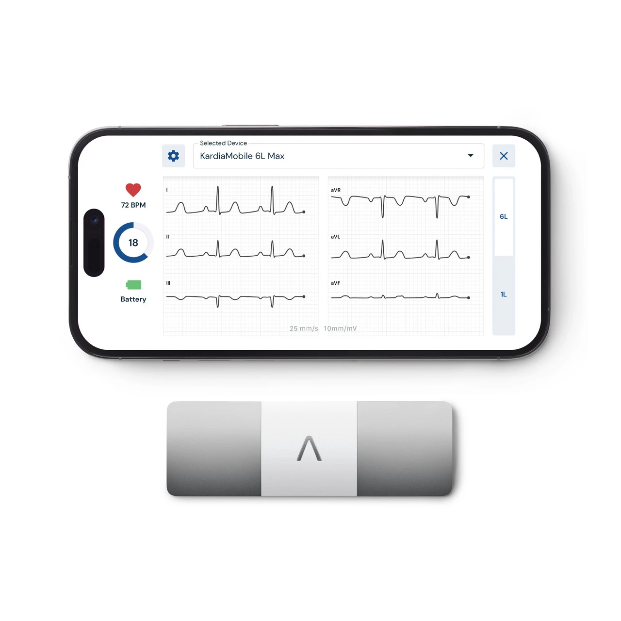 AliveCor KardiaMobile 6L official product image